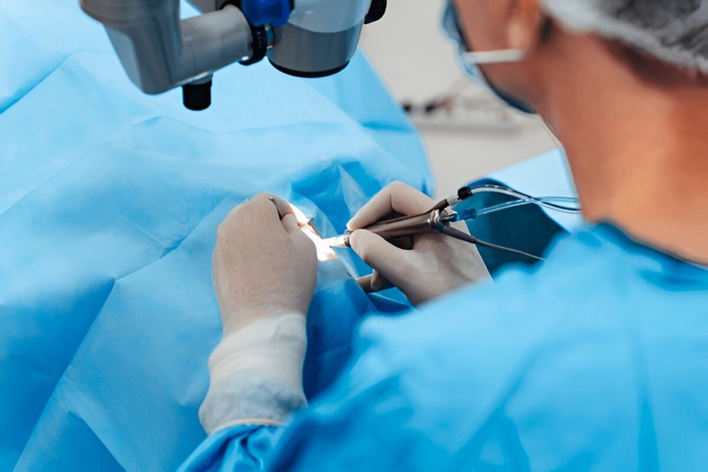 How Long Should You Wait Between Cataract Surgeries on Each Eye? How Long Should You Wait Between Cataract Surgeries on Each Eye?