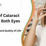 Benefits of Cataract Surgery in Both Eyes
