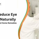 How to Reduce Eye Number Naturally