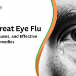 How long does eye flu last?