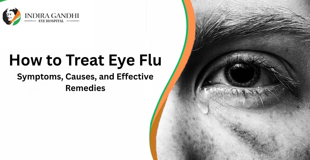 How long does eye flu last?