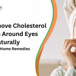 how to remove cholesterol deposits around eyes naturally