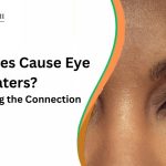 What causes floaters in the eye?