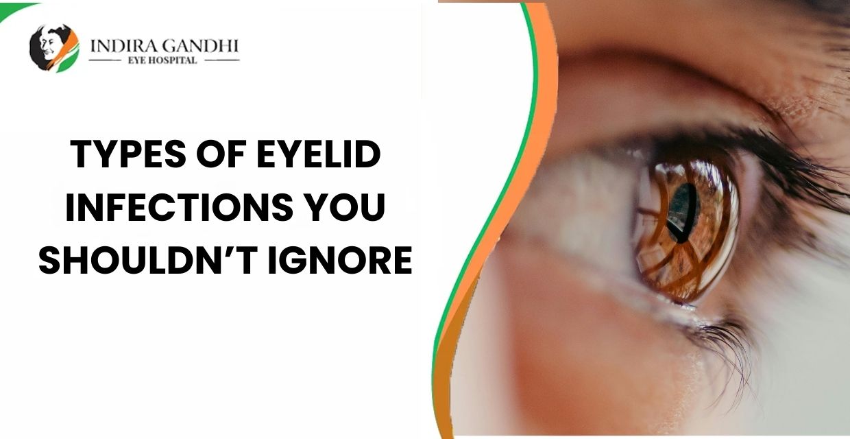 Eyelid Infections