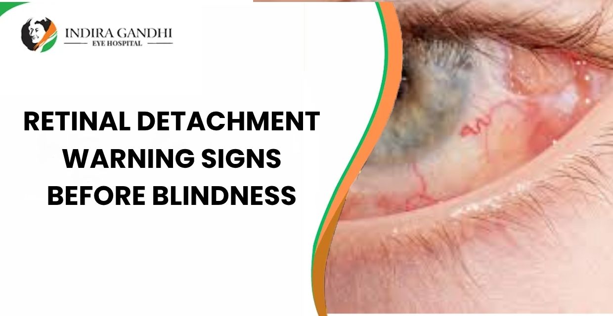 Retinal Detachment Warning Signs Before Blindness Retinal Detachment Warning Signs Before Blindness